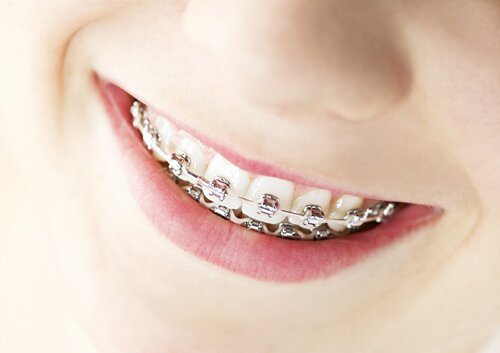 orthodontics-whole-body_24493259